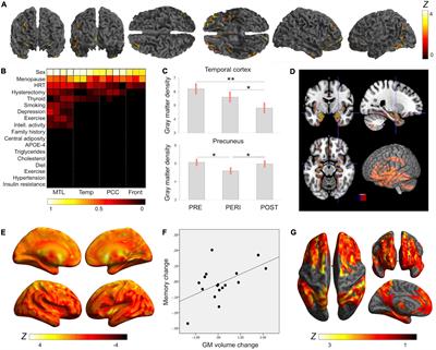 Endogenous and Exogenous Estrogen Exposures: How Women’s Reproductive Health Can Drive Brain Aging and Inform Alzheimer’s Prevention